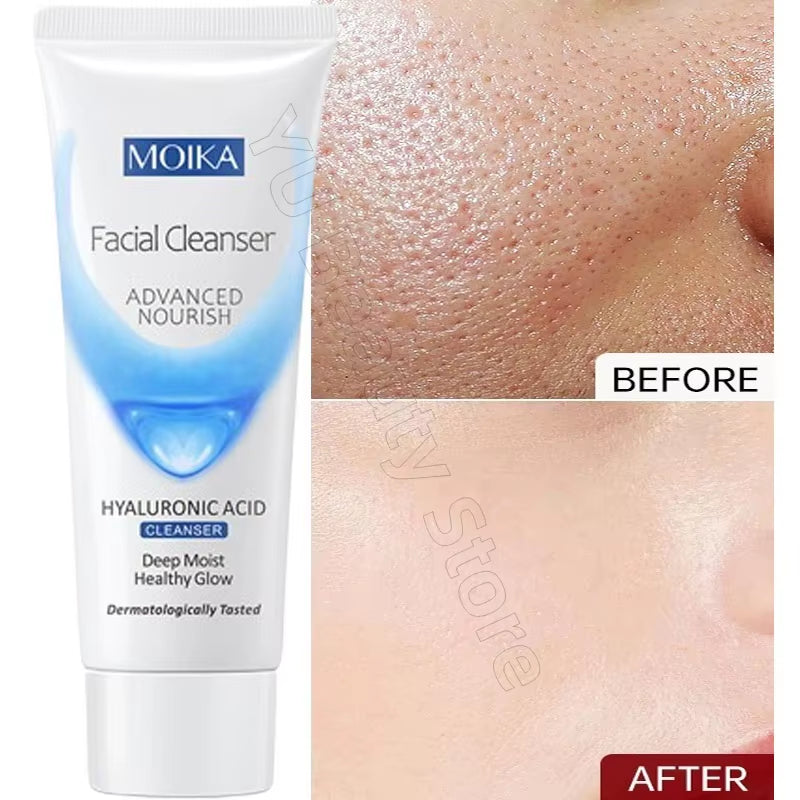 Facial Foam Cleanser Gentle Cleansing Pores Oil Control Blackhead Removal Whitening Moisturizing Korean Skin Care Products 80G