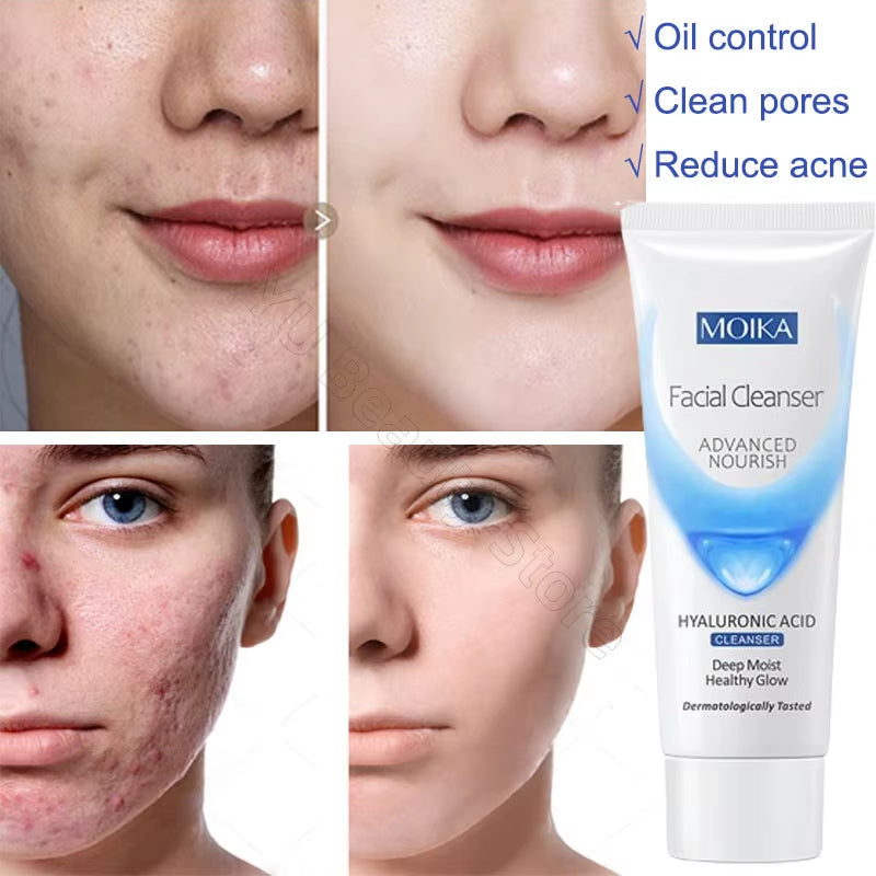 Facial Foam Cleanser Gentle Cleansing Pores Oil Control Blackhead Removal Whitening Moisturizing Korean Skin Care Products 80G