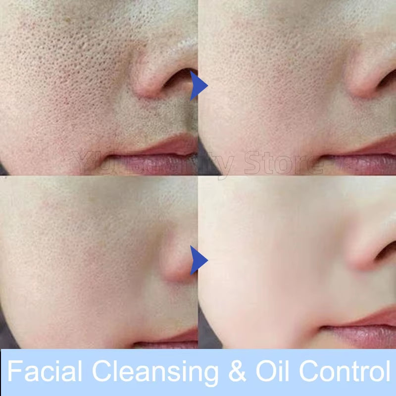 Facial Foam Cleanser Gentle Cleansing Pores Oil Control Blackhead Removal Whitening Moisturizing Korean Skin Care Products 80G